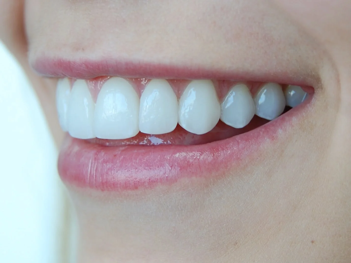 Porcelain veneers, after treatment, right side view of smile